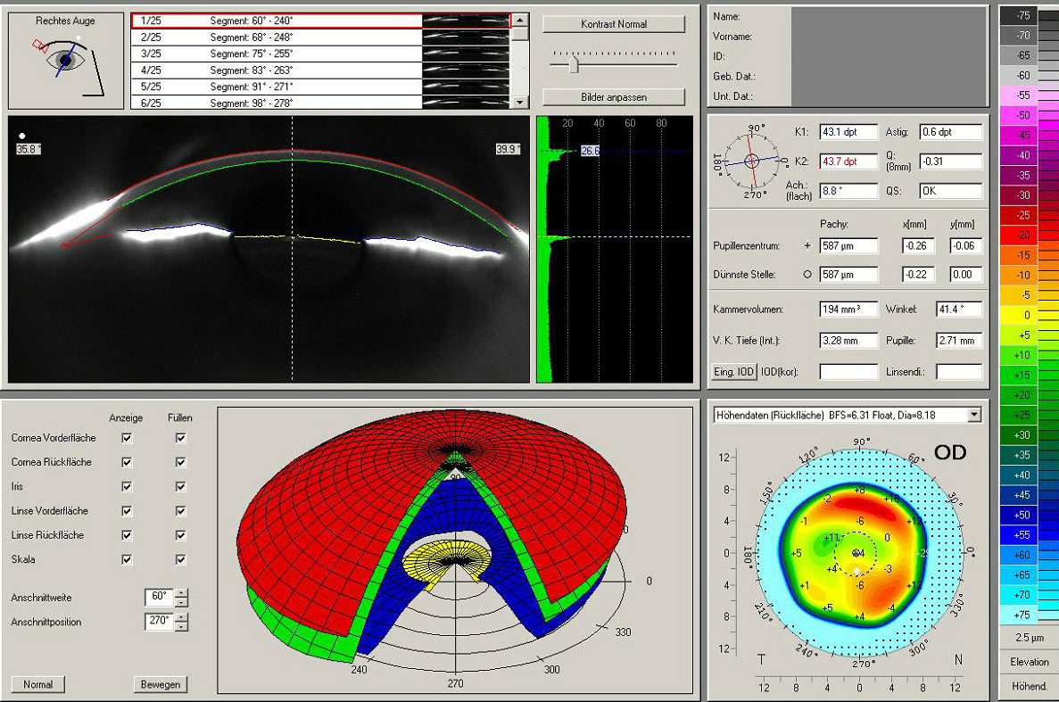 Bild Pachymeter-Daten